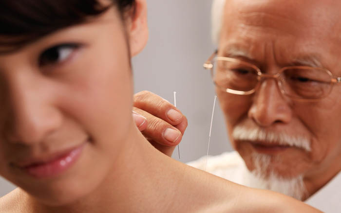 Acupunctuur behandeling TCM klniniek Shnzhou Amsterdam